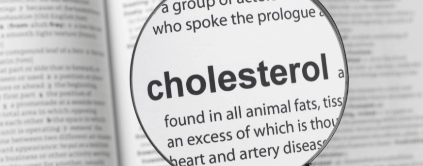 The Ultimate Guide For Seniors Cholesterol How Often Should I Check My Cholesterol Image Shows word cholesterol in the book